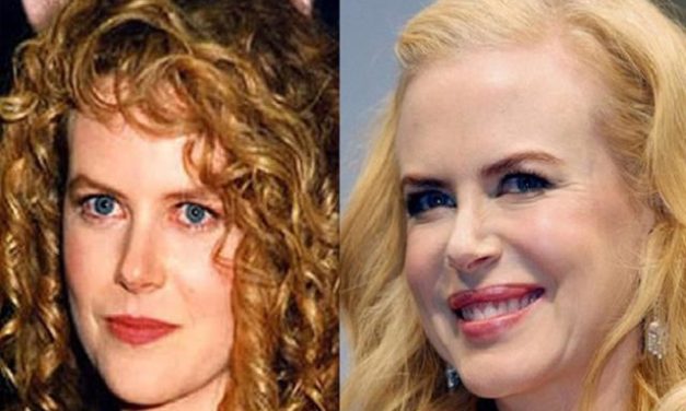 Nicole Kidman e l’eterna giovinezza.